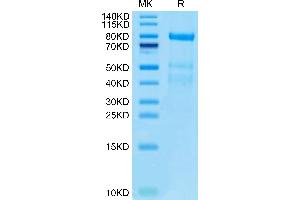Complement Factor I Protein (CFI) (AA 19-583) (His tag)