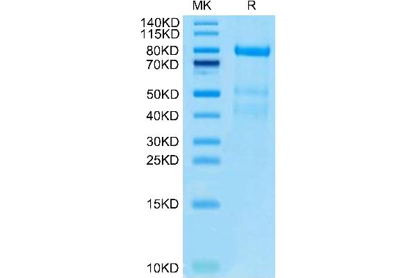Complement Factor I Protein (CFI) (AA 19-583) (His tag)