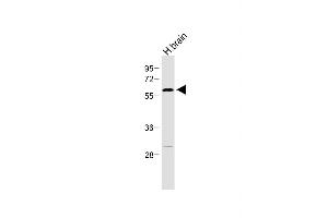 Anti-RORA Antibody  at 1:500 dilution + Human brain lysate Lysates/proteins at 20 μg per lane. (RORA antibody  (AA 193-222))