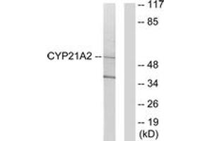 Western blot analysis of extracts from 293 cells, using Cytochrome P450 21A2 Antibody. (CYP21A2 antibody  (AA 151-200))
