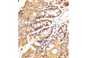 (ABIN6242230 and ABIN6577881) staining Epcam in Mouse colon tissue sections by Immunohistochemistry (IHC-P - paraformaldehyde-fixed, paraffin-embedded sections). (EpCAM antibody  (C-Term))