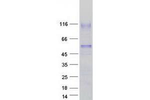 Validation with Western Blot
