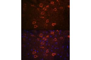 Immunofluorescence analysis of mouse brain using SLC18 Rabbit pAb (ABIN7270410) at dilution of 1:100 (40x lens). (SLC18A3 antibody  (AA 1-150))