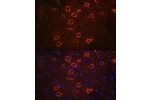 Immunofluorescence analysis of mouse brain using SLC18 Rabbit pAb (ABIN7270410) at dilution of 1:100 (40x lens). (SLC18A3 antibody  (AA 1-150))