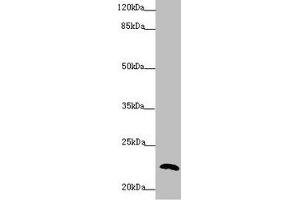 Western blot All lanes: PPIF antibody at 5. (PPIF antibody  (AA 30-207))