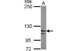 Western Blotting (WB) image for anti-Exportin 6 (XPO6) (AA 135-383) antibody (ABIN1501767)