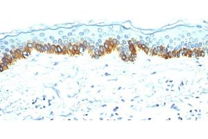 Formalin-fixed, paraffin-embedded human Skin stained with Cytokeratin, LMW Mouse Monoclonal Antibody (AE-1). (Keratin 77 antibody)