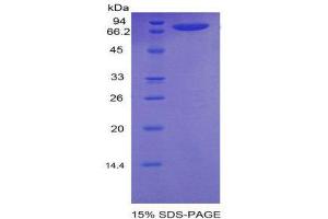 SDS-PAGE (SDS) image for Neuropilin 1 (NRP1) (AA 27-152) protein (His tag,MBP tag) (ABIN2123786)