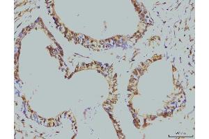 IHC analysis of RPA32/RPA2 using anti-RPA32/RPA2 antibody (ABIN7601379). (RPA2 antibody  (AA 34-254))