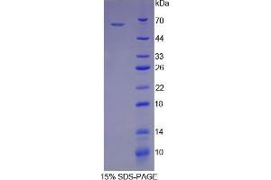 SDS-PAGE (SDS) image for Heat Shock 60kDa Protein 1 (Chaperonin) (HSPD1) (AA 1-573) protein (His tag) (ABIN1079824)