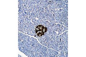 UCHL1 Antibody (C-term) (ABIN388870 and ABIN2839166) immunohistochemistry analysis in formalin fixed and paraffin embedded human cerebellum tissue followed by peroxidase conjugation of the secondary antibody and DAB staining. (UCHL1 antibody  (C-Term))