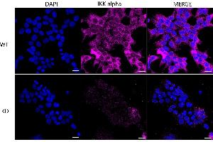 Immunocytochemical staining of HeLa cells using IKK alpha antibody (ABIN7798147), 1:1,000), Top panel: wild-type (WT), Bottom panal: IKK alpha shRNA knockdown (KD). (Recombinant IKK alpha antibody)