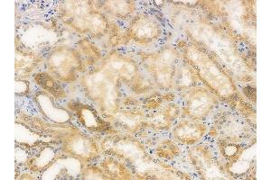 ABIN6254866 and ABIN6274062 at 1/100 staining human normal kidney tissue by IHC-P. (alpha Tubulin antibody  (acLys40))