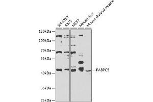 Western blot analysis of extracts of various cell lines, using P antibody  at 1:1000 dilution.