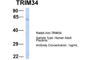 Host:  Rabbit  Target Name:  TRIM34  Sample Type:  Human Adult Placenta  Antibody Dilution:  1. (TRIM34 antibody  (N-Term))