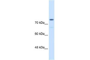 WB Suggested Anti-ACTN4 Antibody Titration:  0. (alpha Actinin 4 antibody  (C-Term))