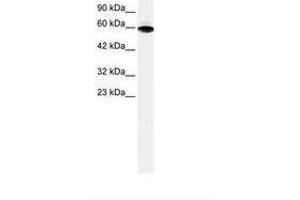 Image no. 3 for anti-Zinc Finger and BTB Domain Containing 7B (ZBTB7B) (AA 313-362) antibody (ABIN202732) (ZBTB7B antibody  (AA 313-362))