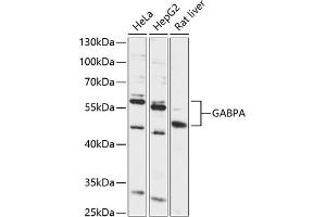 Western blot analysis of extracts of various cell lines, using GABPA antibody (ABIN6133717, ABIN6140888, ABIN6140891 and ABIN6215915) at 1:1000 dilution. (GABPA antibody  (AA 1-100))