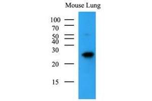 Western Blotting (WB) image for anti-BCL2-Antagonist/killer 1 (BAK1) (AA 29-187) antibody (ABIN933058)