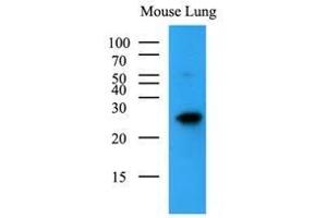 Mouse lung lysates (35 ug) were resolved by SDS-PAGE, transferred to nitrocellulose membrane and probed with anti-human BAK1 (1:500).
