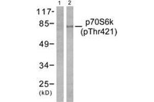 Western blot analysis of extracts from NIH-3T3 cells treated with EGF 200ng/ml 30', using p70 S6 Kinase (Phospho-Thr421) Antibody.