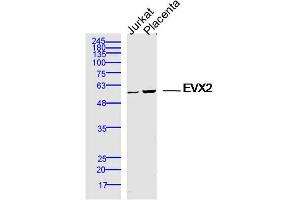 Lane 1: jurkat lysates Lane 2: mouse placenta lysates probed with EVX2 Polyclonal Antibody, Unconjugated  at 1:300 dilution and 4˚C overnight incubation.