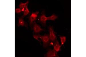 ABIN6272466 staining Hela by IF/ICC. (ZIP2 antibody  (N-Term))