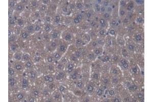 Detection of ZRF1 in Mouse Liver Tissue using Polyclonal Antibody to Zuotin Related Factor 1 (ZRF1) (DNAJC2 antibody  (AA 368-621))