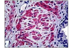 Human Prostate: Formalin-Fixed, Paraffin-Embedded (FFPE) (COL5A2 antibody  (C-Term, Chain alpha 2))