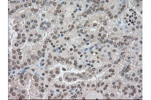 Image no. 2 for anti-Budding Uninhibited By Benzimidazoles 1 Homolog beta (Yeast) (BUB1B) antibody (ABIN1497000) (BUB1B antibody)