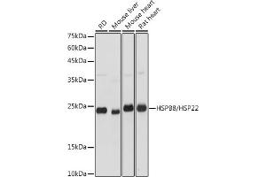 Western blot analysis of extracts of various cell lines, using HSPB8/HSP22 antibody (ABIN3016166, ABIN3016167, ABIN3016168 and ABIN6219596) at 1:3000 dilution.