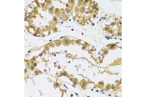 Immunohistochemistry of paraffin-embedded human breast using RPS12 antibody (ABIN5973491) at dilution of 1/100 (40x lens).