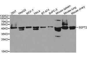 Western blot analysis of extracts of various cell lines, using SEPT2 antibody. (Septin 2 antibody)