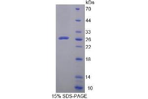 SDS-PAGE (SDS) image for Leupaxin (LPXN) (AA 1-208) protein (His tag) (ABIN4989365) (Leupaxin Protein (LPXN) (AA 1-208) (His tag))