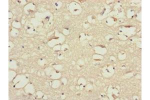 Immunohistochemistry of paraffin-embedded human brain tissue using ABIN7145604 at dilution of 1:100 (BLOC1S2 antibody  (AA 44-142))