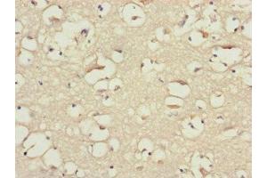 Immunohistochemistry of paraffin-embedded human brain tissue using ABIN7145604 at dilution of 1:100