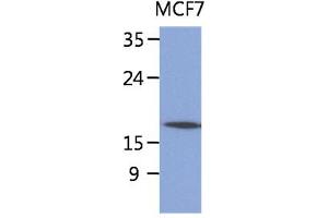 The lysate of MCF7 (40ug) were resolved by SDS-PAGE, transferred to PVDF membrane and probed with anti-human SSR4 antibody (1:1000).