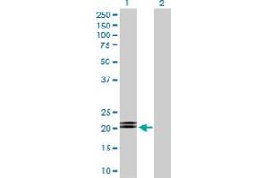 Western Blot analysis of MBD5 expression in transfected 293T cell line by MBD5 MaxPab polyclonal antibody. (MBD5 antibody  (AA 1-229))