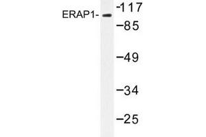 Image no. 2 for anti-Endoplasmic Reticulum Aminopeptidase 1 (ERAP1) antibody (ABIN272255) (ERAP1 antibody)