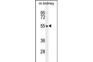 FBXO47 Antibody (N-term) (ABIN655283 and ABIN2844874) western blot analysis in mouse kidney tissue lysates (35 μg/lane).