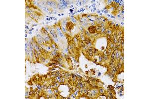 Immunohistochemistry (IHC) image for anti-Trefoil Factor 1 (TFF1) (AA 25-84), (pSer2) antibody (ABIN3015566)