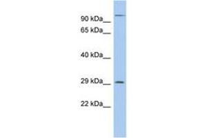 Image no. 1 for anti-Kv Channel Interacting Protein 2 (KCNIP2) (AA 35-84) antibody (ABIN6742555) (KCNIP2 antibody  (AA 35-84))