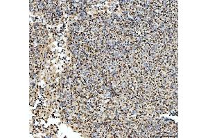 IHC analysis of SFPQ using anti-SFPQ antibody (ABIN7603089).