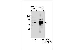 Western blot analysis of extracts from A431 cell,untreated or treated with EGF,100 ng/mL,using Phospho-MEK1-p(left) or MEK1-p Antibody (right). (MEK1 antibody  (pSer222))