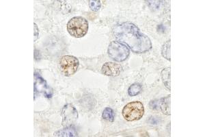Immunohistochemistry (IHC) image for anti-DEAD (Asp-Glu-Ala-Asp) Box Polypeptide 46 (DDX46) (C-Term) antibody (ABIN7448521)