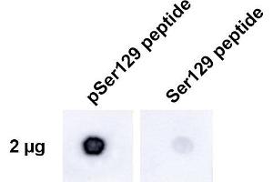 Dot Blot analysis using Rabbit Anti-Alpha Synuclein pSer129 Monoclonal Antibody, Clone J18 (ABIN6932864). (SNCA antibody  (pSer129) (Atto 594))