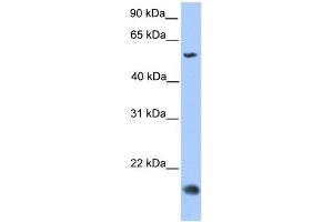 WB Suggested Anti-CMTM8 Antibody Titration: 0. (CMTM8 antibody  (Middle Region))