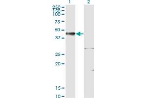 Western Blot analysis of ISL1 expression in transfected 293T cell line by ISL1 monoclonal antibody (M02), clone 4A7.
