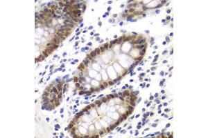 Immunohistochemistry of paraffin-embedded human colon using MSH6 antibody. (MSH6 antibody)