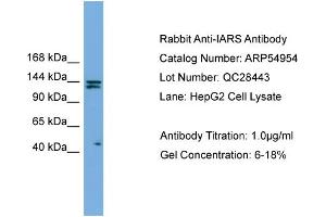 WB Suggested Anti-IARS  Antibody Titration: 0. (IARS antibody  (Middle Region))
